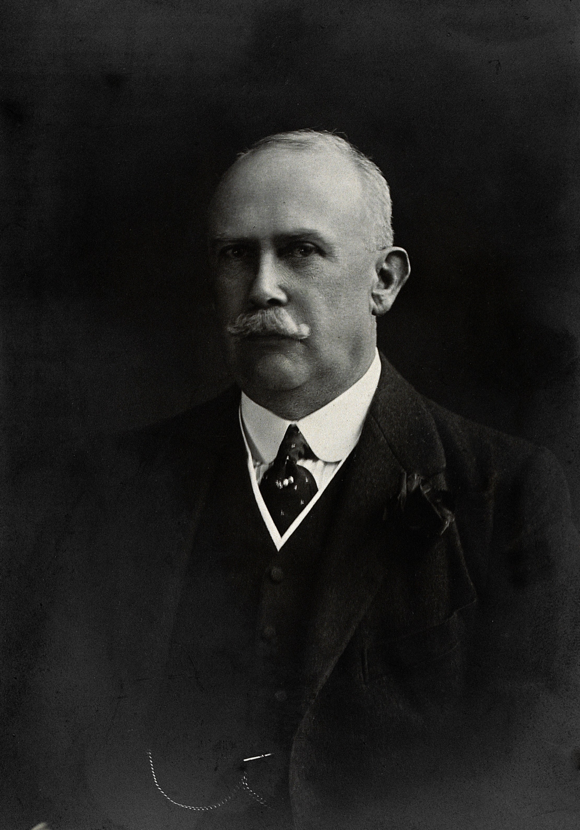 William Hugh Fenton. Photograph by Thomson. Wellcome V0026362