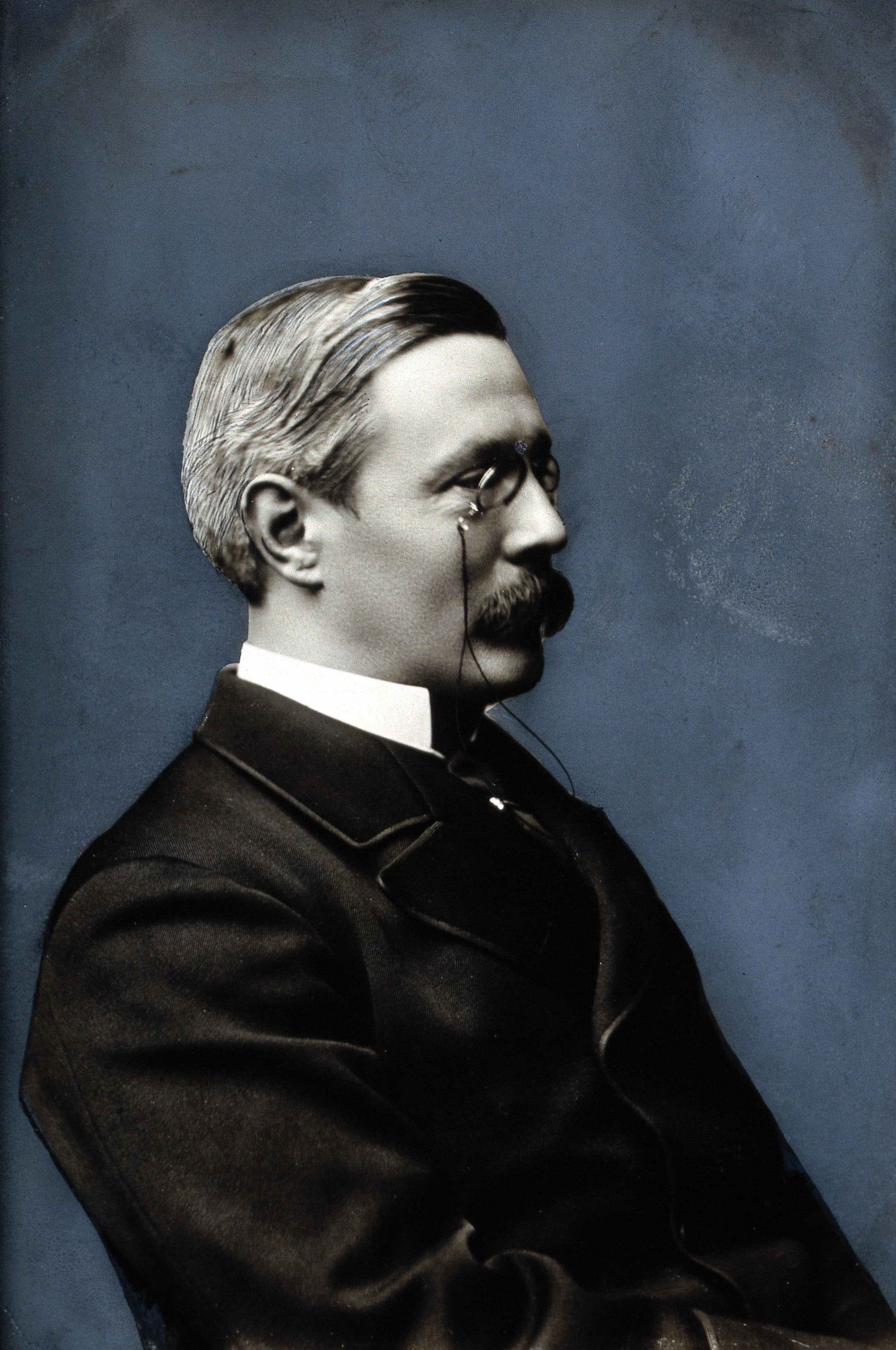 William Smith Greenfield. Photograph. Wellcome V0028710